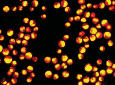 Parachlorella kessleri overproducing neutral lipids